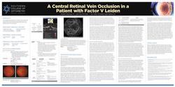 A Central Retinal Vein Occlusion in a Patient with Factor V Leiden